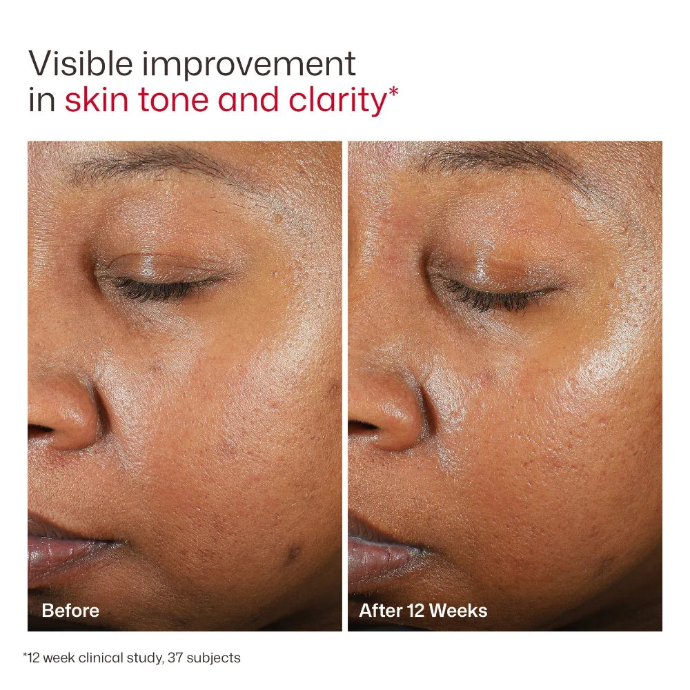 EltaMD UV Clear Tinted Broad-Spectrum SPF 46